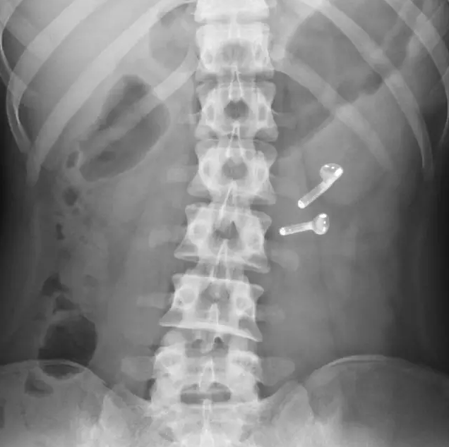 【吐槽合集】iphone7日抛型耳机被网友玩坏了